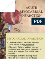 Myocardial Infarction ..Luci