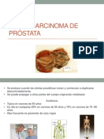 Adenocarcinoma de Próstata