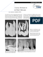 MB2 Canal Systems in Maxillary First Mollars