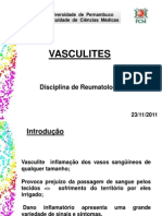 Vasculites: classificação e principais doenças