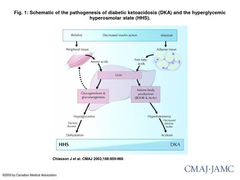 Fig. 1: Schematic of The Pathogenesis of Diabetic Ketoacidosis (DKA ...