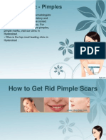 Oliva Clinic - Pimples: Pimple Treatment