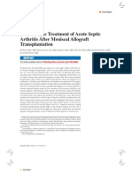 Arthroscopic Treatment of Acute Septic Arthritis After Meniscal Allograft Transplantation