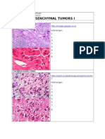 Mesencymmal Tumor