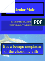 Vesicular Mole: Dr. Mohammed Abdalla Egypt, Domiat G. Hospital