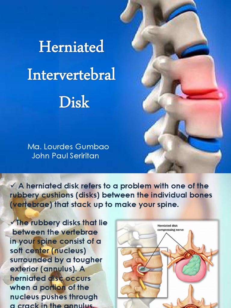 Herniated Intervertebral Disc | PDF | Physical Therapy | Vertebral Column