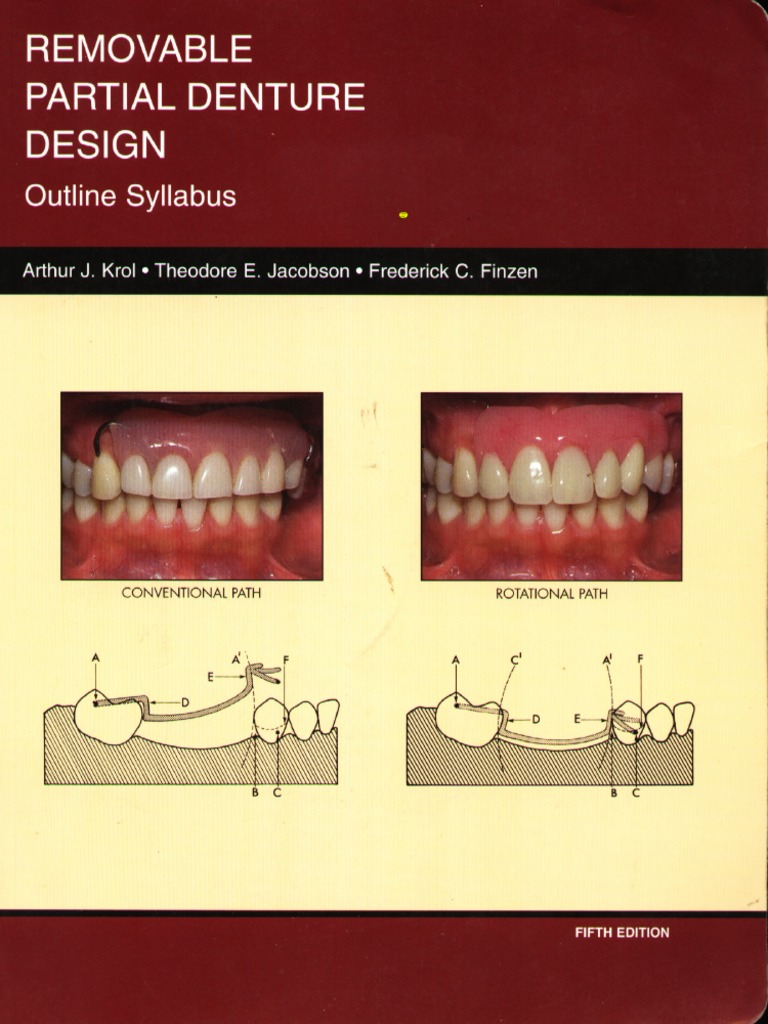 Krol, Removable Partial Denture DesignOutline Syllabus Dentistry