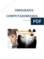 Tomografia Computadorizada