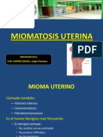 Miomatosis Uterina