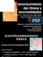 ECGs Arritmias y Anormalidades R