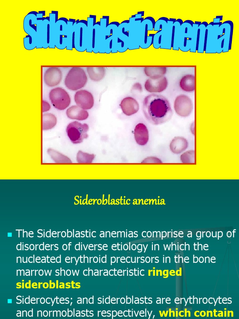 sideroblastic anemia pathophysiology