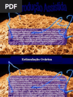 Reprodução Assistida