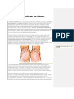 Causas y Remedios Naturales para Talones Agrietados