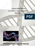 Epilepsia Mioclonica Con Fibras Rojas Rasgadas