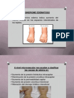 Causas y clasificación del síndrome edematoso