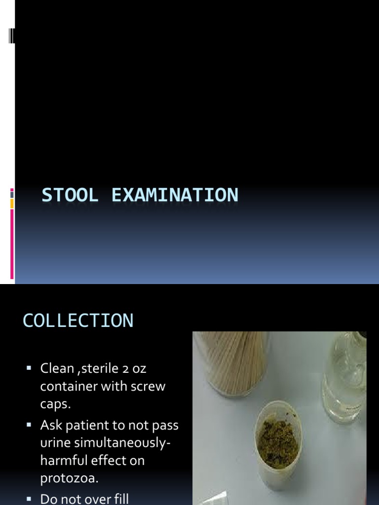 Stool Examination Feces Human Feces