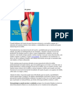 Tendinitis de La Pata de Ganso