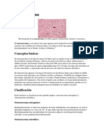 Osteosarcoma.docx