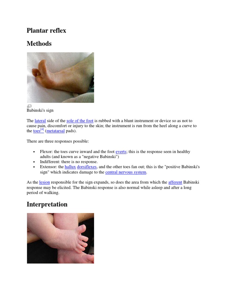 Plantar Reflex Anatomy Nervous System