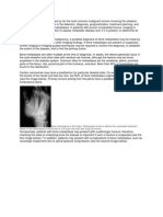 Imaging in Bone Metastase