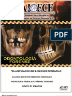 Clasificacion de Lesiones Dentarias