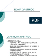 Carcinoma Gastrico Done