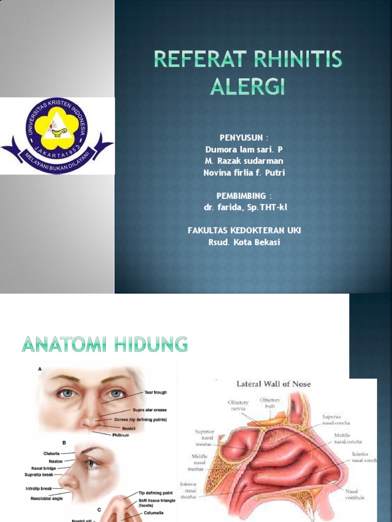 Rinitis Alergi: Gejala dan Penanganan | PDF