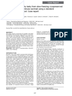 Live Birth of A Healthy Baby From Slow-Freezing Cryopreserved Pronuclear Stage Embryos Warmed Using A Standard Devitrification Protocol: Case Report