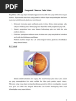 Download Pengaruh Dm Pada Mata by Farah Pratiwi SN155527489 doc pdf