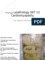 Morphopathology SET 12 Cardiomyopathy (Ischemic) : by Qamar Ahmad