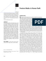 Fracture Modes in Human Teeth