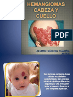 Seminario Hemangiomas. Cabeza y Cuello