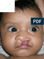 Cleft lip and Palate information  brochure