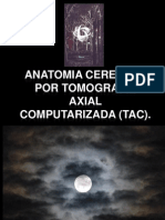 Anatomia Cerebral Por Tomografia