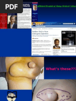 Download External Hernia by sanjivdas SN15609907 doc pdf