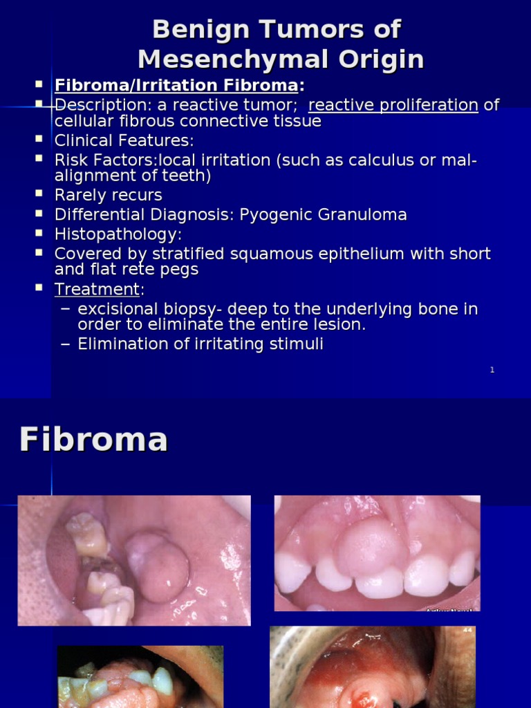 Benign Oral Tumors of Mesenchymal Tissue Origin | PDF | Neoplasms ...