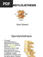 Download SPONDYLOLISTHESIS by JulioYoko SN156860970 doc pdf