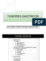 Tumores Gastricos