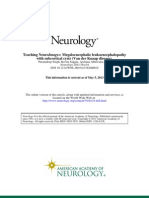 With Subcortical Cysts (Van Der Knaap Disease) : Megaloencephalic Leukoencephalopathy Teaching Neuro