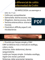 Diagnostico Diferencial de Colitis Ulcerosa y Enfermedad De