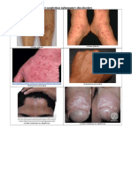 Other Nonifectious Inflammatory Skin Disorders