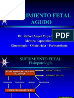 30.sufrimiento Fetal