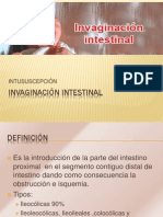 Invaginacion Intestinal