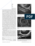 EUS in Common Bile Duct Stones Laurent Palazzo, MD, Dermot O'Toole, MD EXAMINATION TECHNIQUE