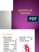 Arteritis de Takayasu 2