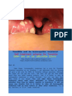 Tonsilitis and Its Homeopathic Self Treatment Scheme DR Bashir Mahmud Ellias