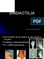 SINDACTILIA -> Futura Médica