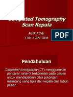 CT Scan Kepala