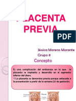 PLACENTA PREVIA: DIAGNÓSTICO Y TRATAMIENTO