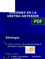 Lesiones de La Uretra Anterior - Futura Médica